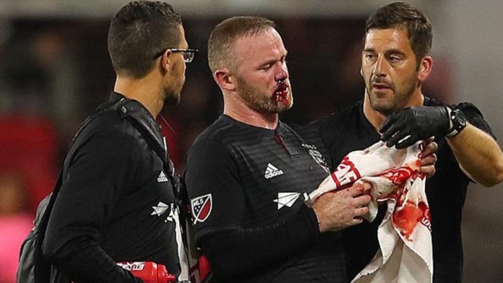 ওয়েন রুনির নাক ফাটিয়ে দিল প্রতিপক্ষ খেলোয়াড়